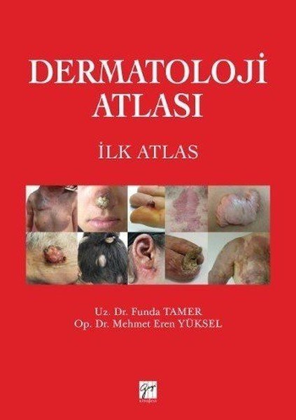 Gazi Kitabevi Dermatoloji Atlası - Funda Tamer, Mehmet Eren Yüksel Gazi Kitabevi