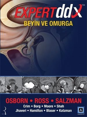 Pelikan Expert DDX: Beyin ve Omurga Pelikan Yayınevi