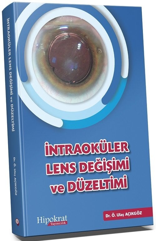 Hipokrat İntraoküler Lens Değişimi ve Düzeltimi - Ö. Ulaş Açıkgöz Hipokrat Kitabevi